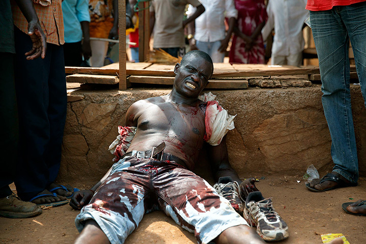Central African Republic: A suspected member of a Christian militia lies wounded by machete blows in 