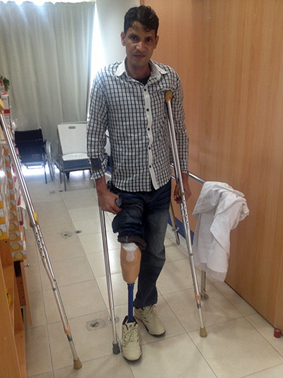 Abu Dhabi workers: Mohammed Arif being fitted for a new leg one year after his amputation. 