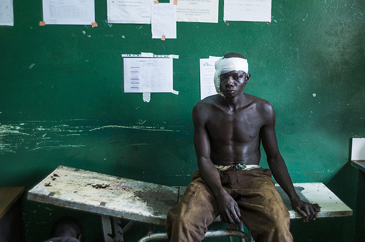 Weekend in pictures: Bangui, Central African Republic: A man wounded during clashes between form