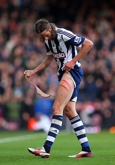 premier league: Jonas Olsson removes a bandage