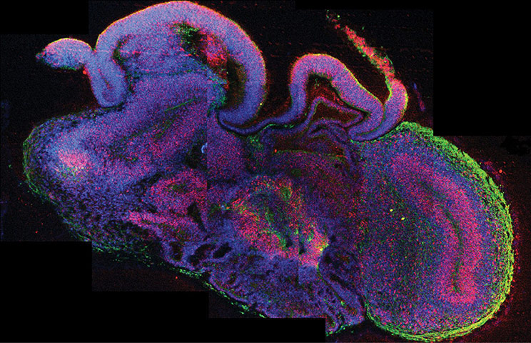 2013 year in science: Miniature 'human brain' grown in laboratory