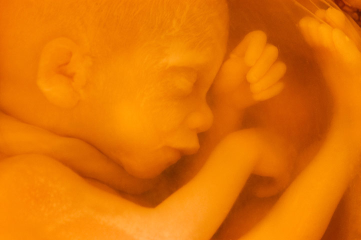 2013 year in science: Human fetus, National Medical Museum, Washington, D.C.