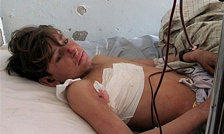 Un niño herido en un hospital afgano en la provincia de Kunar después de un ataque aéreo de la OTAN deja 10 civiles muertos