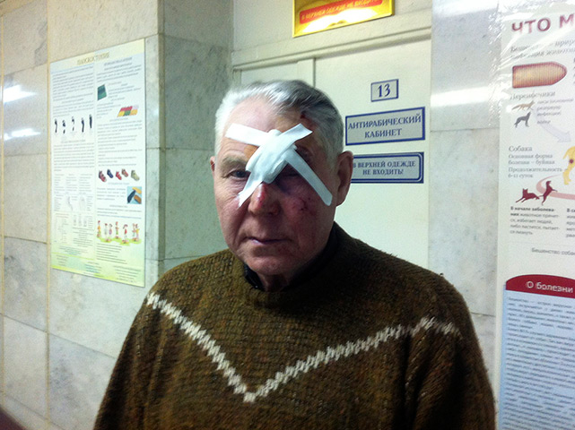 meteorites in Russia: An injured local man in a hospital in Chelyabinsk