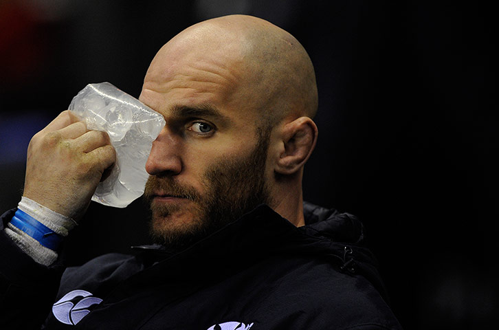 England v Scotland: Alasdair Strokosch puts an ice pack on his eye