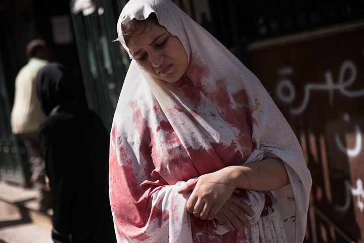 Sony World Professional: A wounded woman, leaves Dar El Sifa hospital in Aleppo, Syria