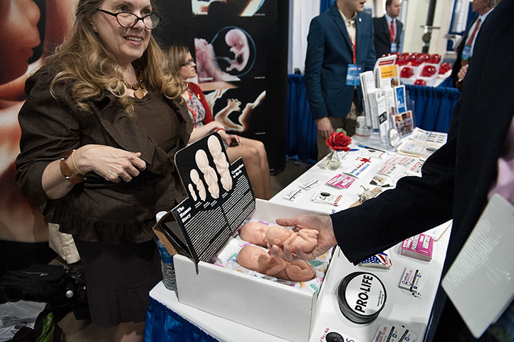 CPAC: 12-week-old foetus