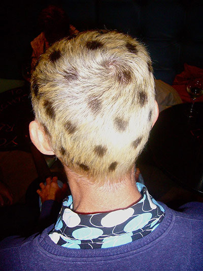 Your Pictures - Spotted: boy with spots on his blond hair