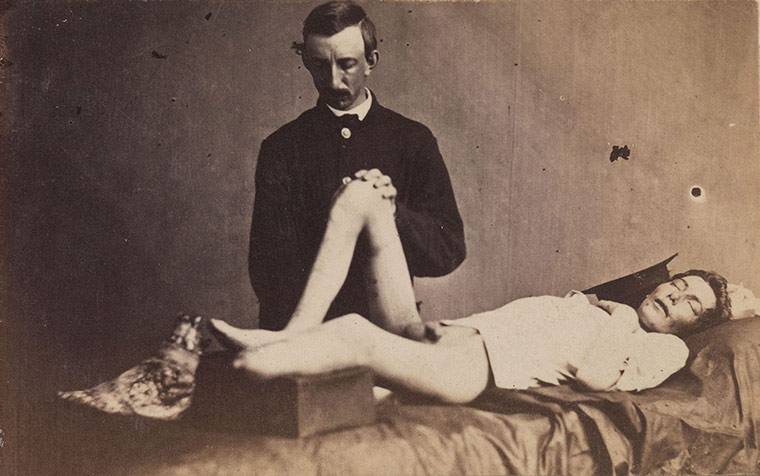 Civil war photography: 179. Private Parmenter Under Anesthesia.jpg