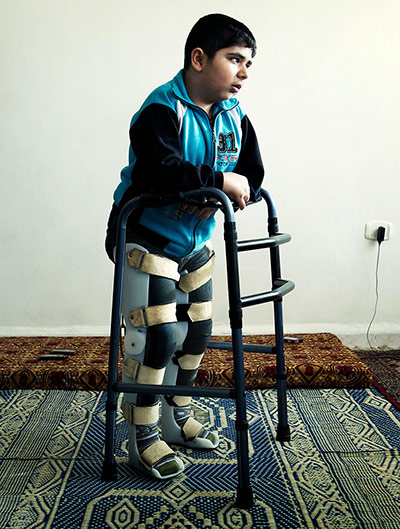 Giles Duley: Bashar, a Syrian refugee who was injured by a tank shell