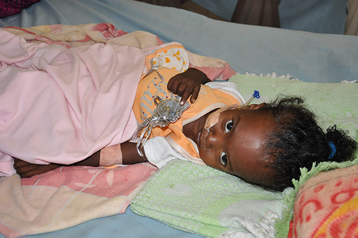 One-year-old Samah Suraj receives treatment for a severe diarrhoea infection