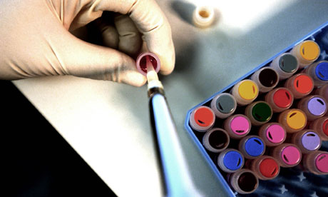 Multi coloured pipettes in a lab