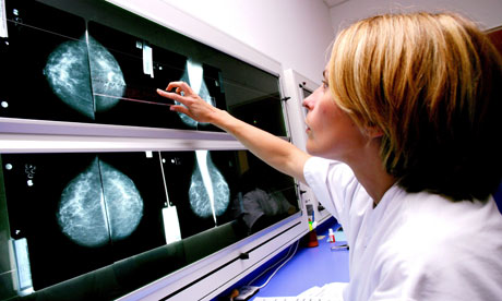 Radiologist examines mammograms