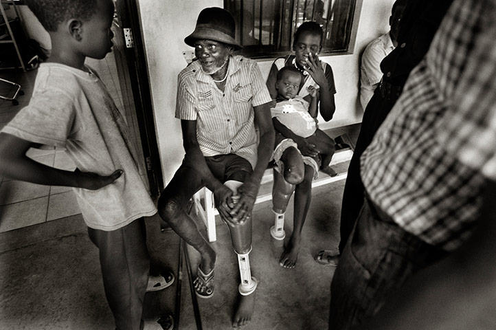 Landmine survivors at rehabilitation centre