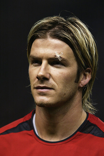 beckham's career: David Beckham of Manchester United with his infamous cut eye