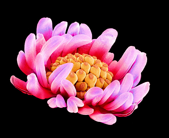 flower micrographs: Buttercup flower (Ranunculus sp.)