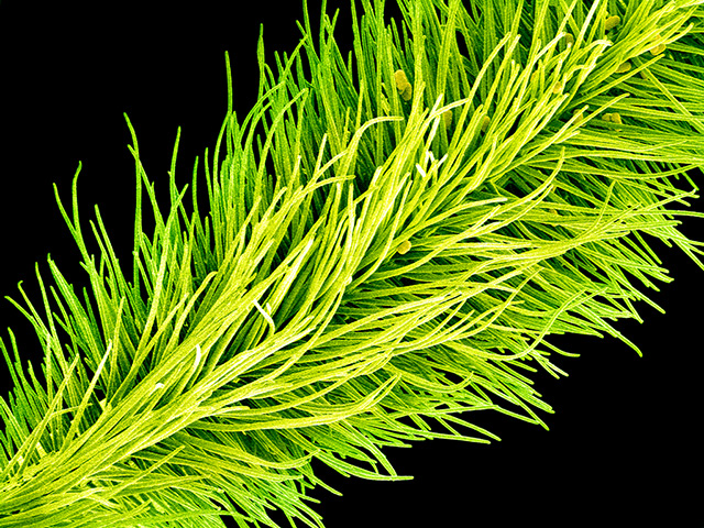 flower micrographs: Pollen grains (ovals) on the stigma of a garden pea flower (Pisum sativum)