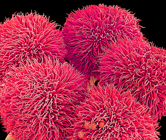 flower micrographs: Hibiscus sp. flower