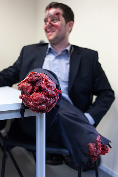 Disaster Exercise: Amputee