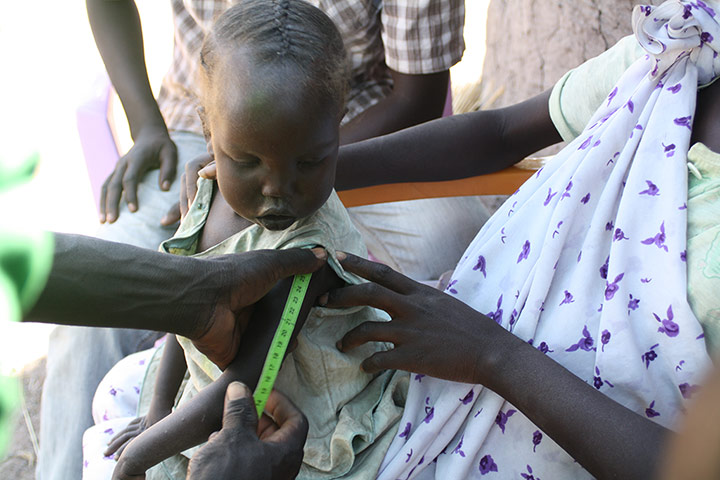World Hunger Day: A young girl’s arm is measured