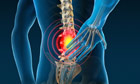 Backache