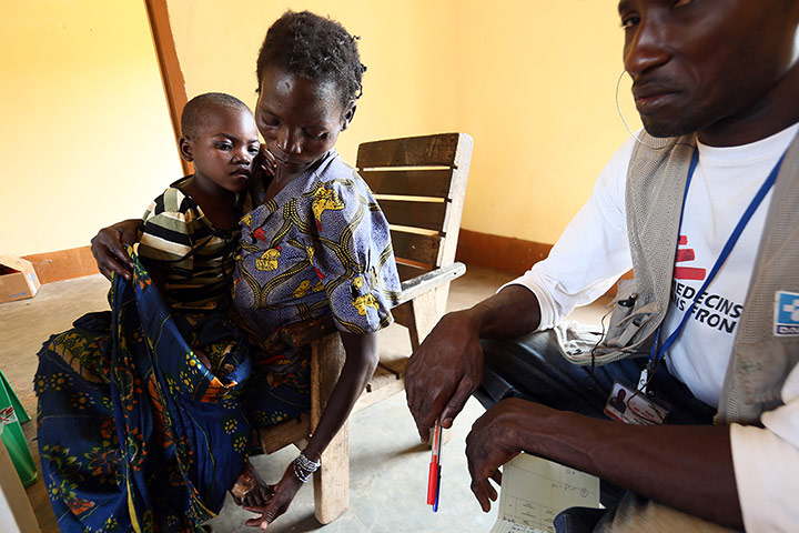 MSF in CAR: Boy bitten by snake