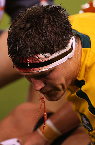 lions gallery 4: Kane Douglas spits blood
