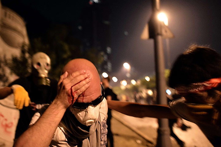 Turkey protests day five: Injured demonstrator