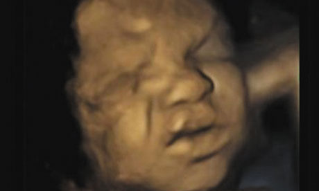 Babies in the womb