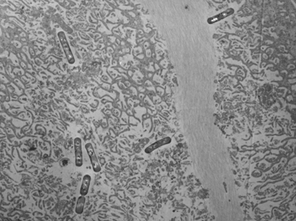Electron micrograph of E. coli