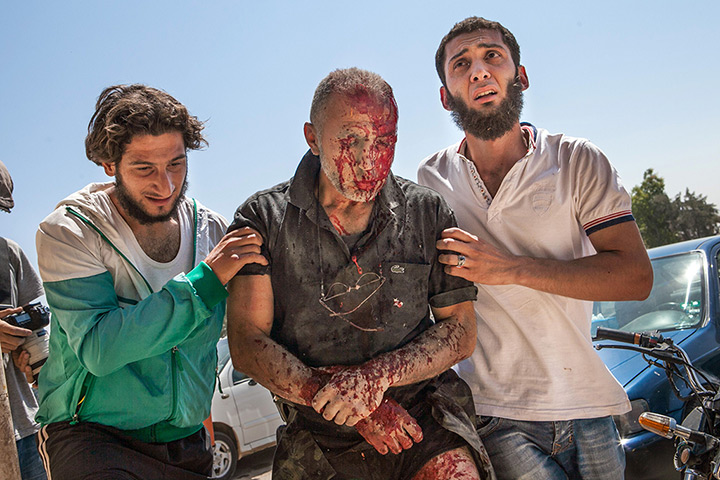 Weekend in pictures: Saraqeb, Syria: Men rush a wounded man to hospital in northwestern Syria af