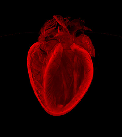 BHF: winners of its Reflections of Research photo competition
