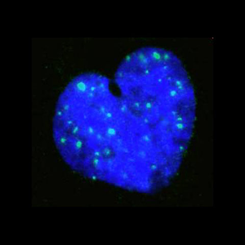 BHF: winners of its Reflections of Research photo competition