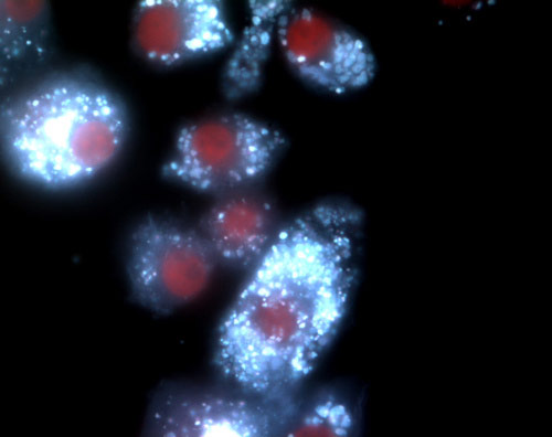 BHF: winners of its Reflections of Research photo competition