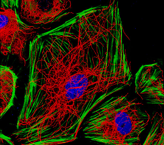 BHF: winners of its Reflections of Research photo competition