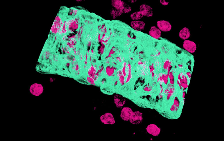 BHF: winners of its Reflections of Research photo competition