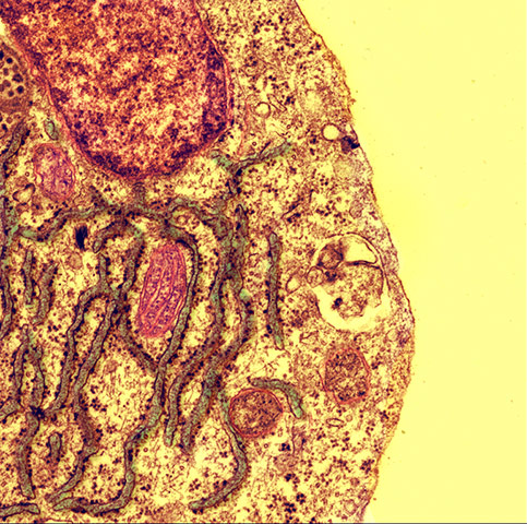 BHF: winners of its Reflections of Research photo competition