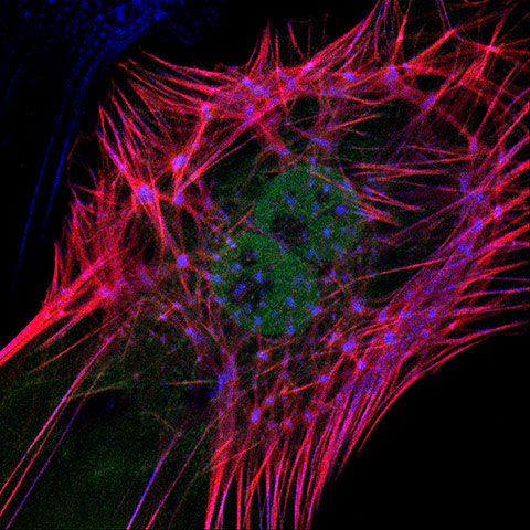 BHF: winners of its Reflections of Research photo competition