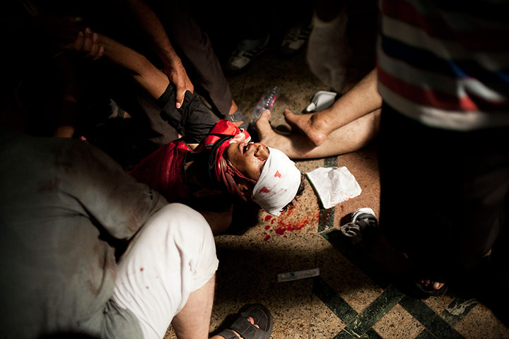 20 Photos: Doctors treat a supporter of Egypt's ousted President Mohammed Morsi