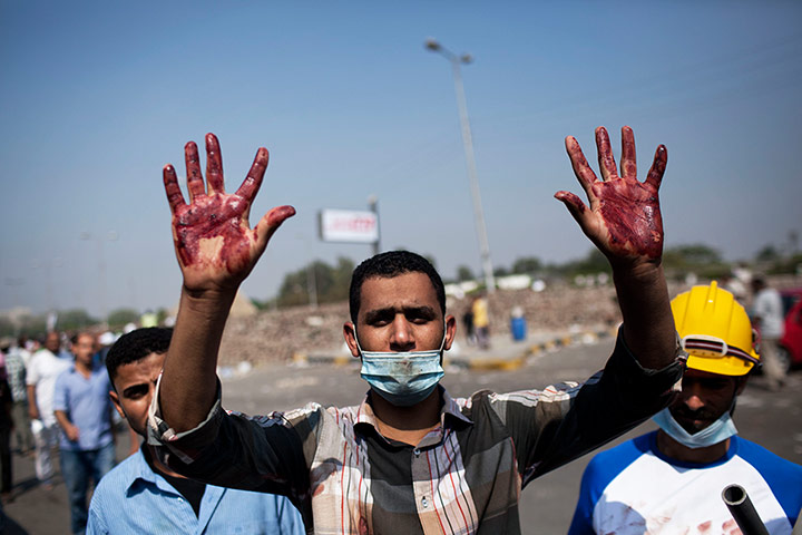 Cairo: A Morsi supporter shows his bloody hands