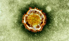 An electron microscope image of a coronavirus