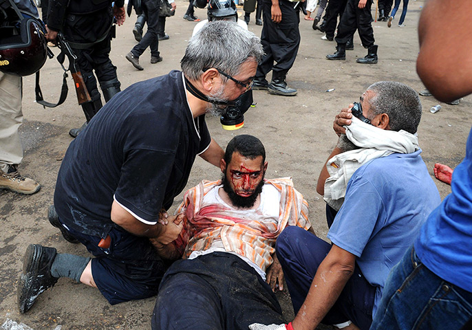 Egyptian camps: A man suffering from tear gas exposure is assisted, after cannisters were f