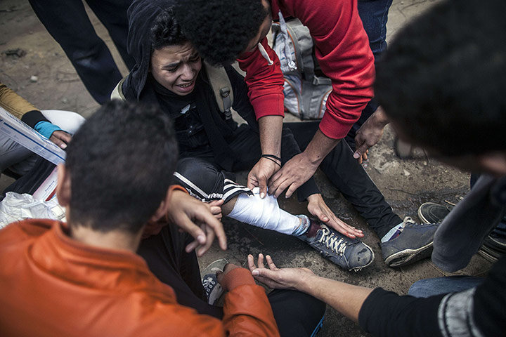 Cairo protest: A protestor injured by a rubber bullet