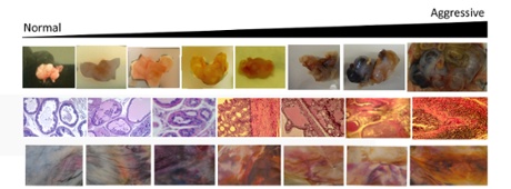 Tumour images along with dyed fabric