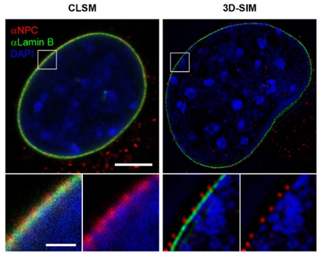 Comparison of two microscopy techniques
