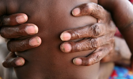 Indigenous child removals