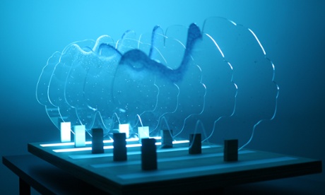 flashing brain installation