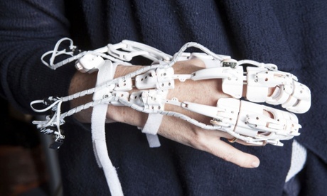 robotic exoskeleton hand