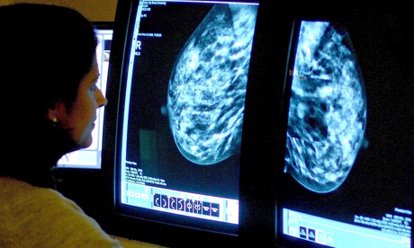 An NHS consultant analysing a mammogram, looking for breast cancer