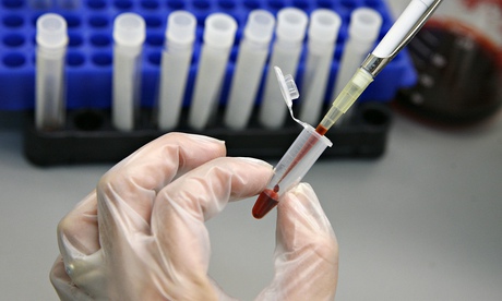 A laboratory technician examines blood samples for HIV/AIDS in a public hospital in Valparaiso city